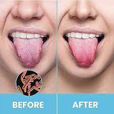 Yellow Teeth & Bad Breath Solution – Herbal Teeth Powder + Tongue Cleaner (100% Effective)